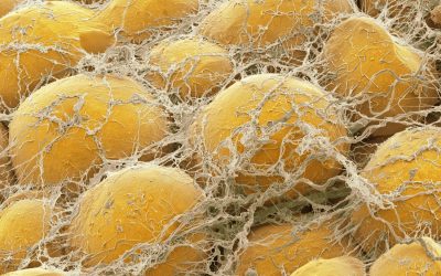 Fat tissue. Coloured scanning electron micrograph (SEM) of fat cells (adipocytes, round) surrounded by fine strands of supportive connective tissue. Adipocytes are among the largest cells in the human body, each cell being 100 to 120 microns in diameter. Almost the entire volume of each fat cell consists of a single lipid (fat or oil) droplet. Adipose tissue forms an insulating layer under the skin, storing energy in the form of fat, which is obtained from food. Magnification: x400 when printed 10 centimetres wide.