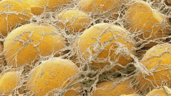 Fat tissue. Coloured scanning electron micrograph (SEM) of fat cells (adipocytes, round) surrounded by fine strands of supportive connective tissue. Adipocytes are among the largest cells in the human body, each cell being 100 to 120 microns in diameter. Almost the entire volume of each fat cell consists of a single lipid (fat or oil) droplet. Adipose tissue forms an insulating layer under the skin, storing energy in the form of fat, which is obtained from food. Magnification: x400 when printed 10 centimetres wide.